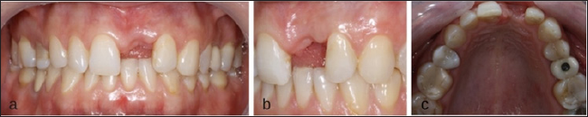 Click here to view Large Figure 3