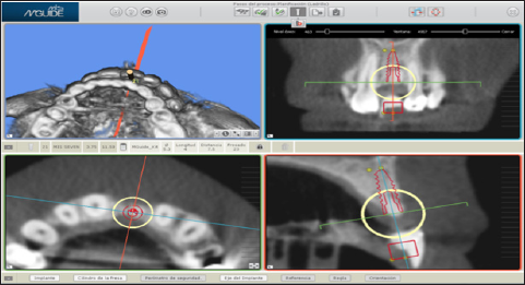 Click here to view Large Figure 4