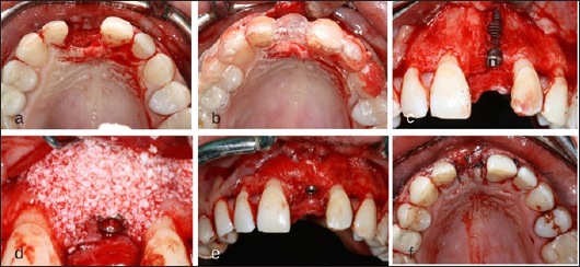 Click here to view Large Figure 5