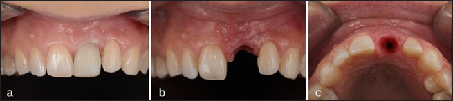 Click here to view Large Figure 6