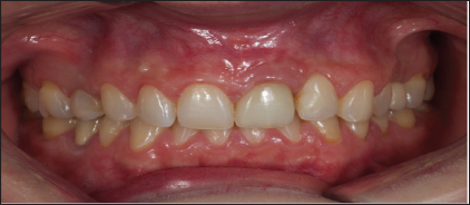 Click here to view Large Figure 9