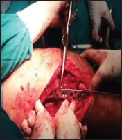 Click here to view Large Figure 4