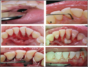 Click here to view Large Figure 1