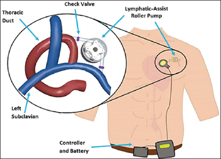 Click here to view Large Figure 1