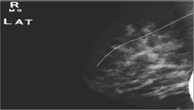 Click here to view Large Figure 3