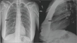 Click here to view Large Figure 4