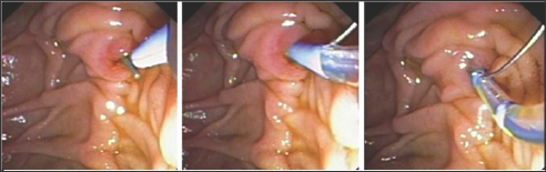 Click here to view Large Figure 1