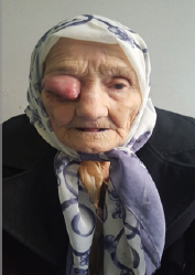 Click here to view Large Figure 1a