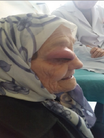 Click here to view Large Figure 1b