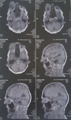 Click here to view Large Figure 4