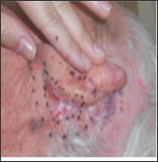 Click here to view Large Figure 6