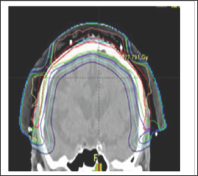 Click here to view Large Figure 7