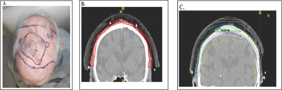 Click here to view Large Figure 9
