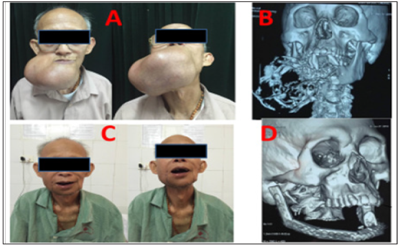 Click here to view Large Figure 1