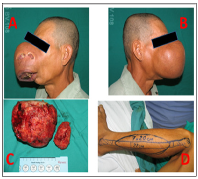 Click here to view Large Figure 2