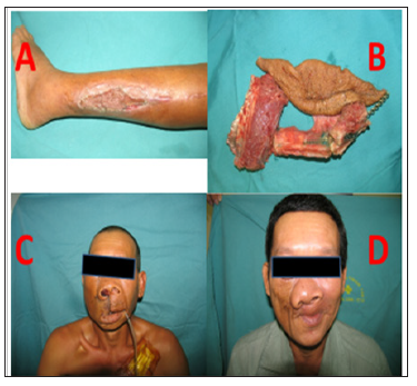 Click here to view Large Figure 3