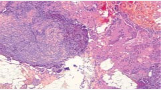 Click here to view Large Figure 2