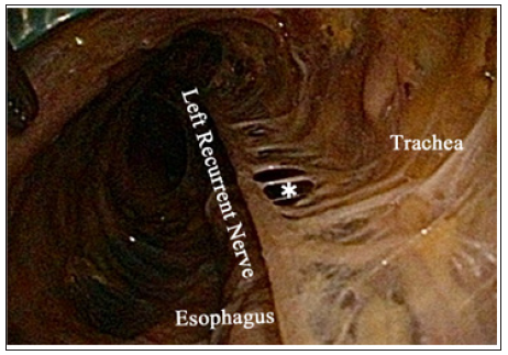 Click here to view Large Figure 4