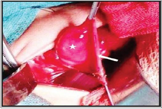 Click here to view Large Figure 1