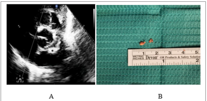 Click here to view Large Figure 4