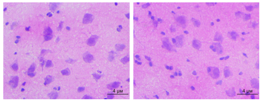 Click here to view Large Figure 1