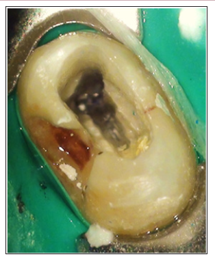 Click here to view Large Figure 1A