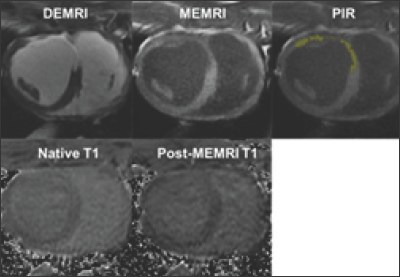 Click here to view Large Figure 1 biomedres-openaccess-journal-bjstr