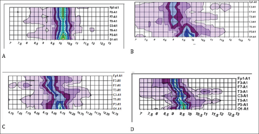 Click here to view Large Figure 1 biomedres-openaccess-journal-bjstr