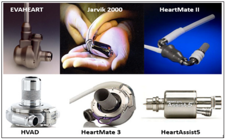 Click here to view Large Figure 1 biomedres-openaccess-journal-bjstr