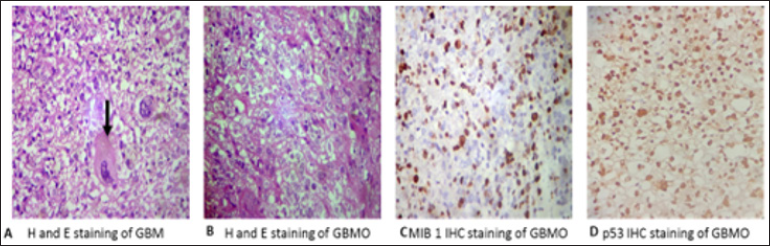 Click here to view Large Figure 1 biomedres-openaccess-journal-bjstr