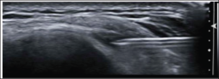 Click here to view Large Figure 1 biomedres-openaccess-journal-bjstr