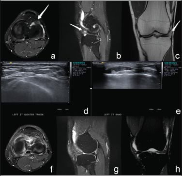Click here to view Large Figure 1 biomedres-openaccess-journal-bjstr