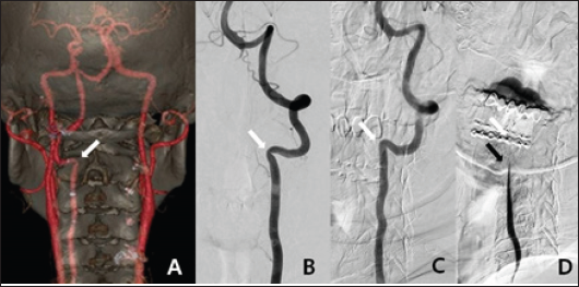 Click here to view Large Figure 1 biomedres-openaccess-journal-bjstr