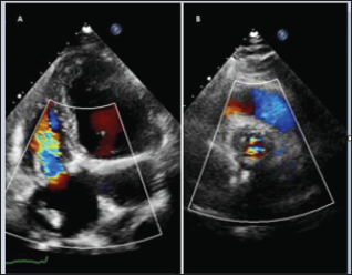Click here to view Large Figure 1 biomedres-openaccess-journal-bjstr