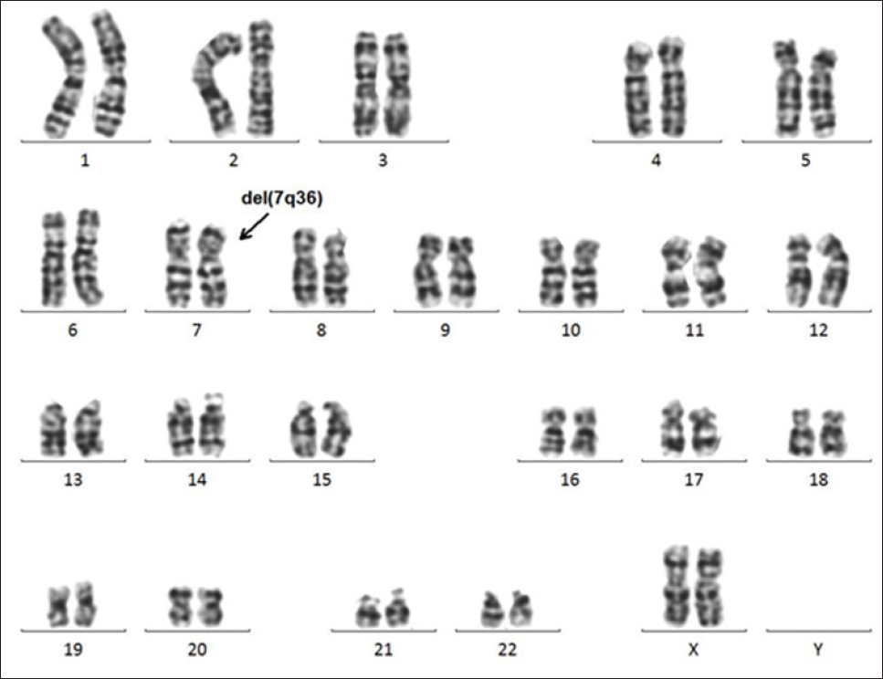 Click here to view Large Figure 1 biomedres-openaccess-journal-bjstr