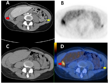 Click here to view Large Figure 1 biomedres-openaccess-journal-bjstr