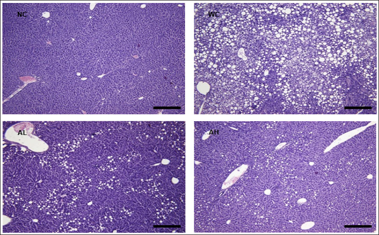 Click here to view Large Figure 1 biomedres-openaccess-journal-bjstr