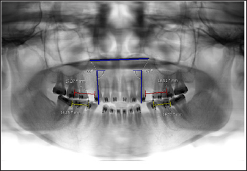 Click here to view Large Figure 1 biomedres-openaccess-journal-bjstr