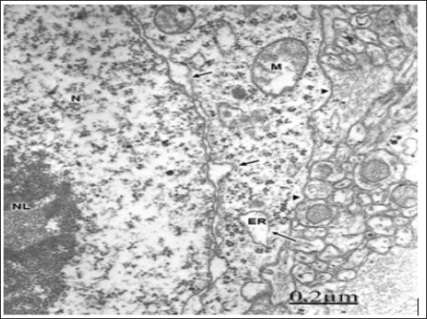 Click here to view Large Figure 1 biomedres-openaccess-journal-bjstr