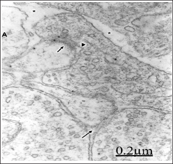 Click here to view Large Figure 1 biomedres-openaccess-journal-bjstr