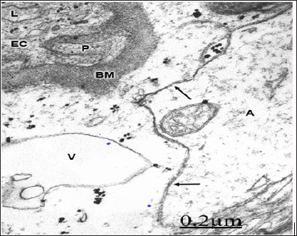 Click here to view Large Figure 1 biomedres-openaccess-journal-bjstr