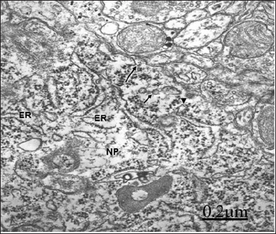 Click here to view Large Figure 1 biomedres-openaccess-journal-bjstr