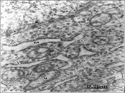 Click here to view Large Figure 1 biomedres-openaccess-journal-bjstr