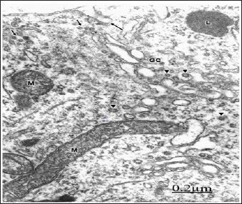 Click here to view Large Figure 1 biomedres-openaccess-journal-bjstr