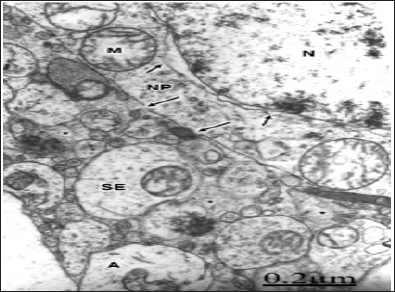 Click here to view Large Figure 1 biomedres-openaccess-journal-bjstr