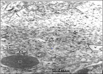 Click here to view Large Figure 1 biomedres-openaccess-journal-bjstr