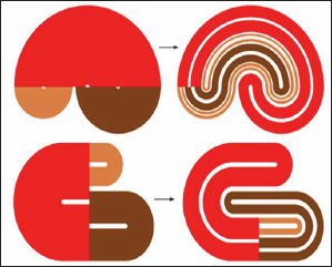 Click here to view Large Figure 1 biomedres-openaccess-journal-bjstr