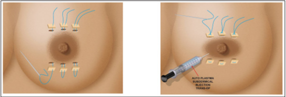 Click here to view Large Figure 7 biomedres-openaccess-journal-bjstr