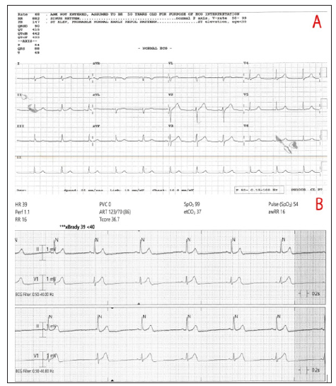 Click here to view Large Figure 1 biomedres-openaccess-journal-bjstr