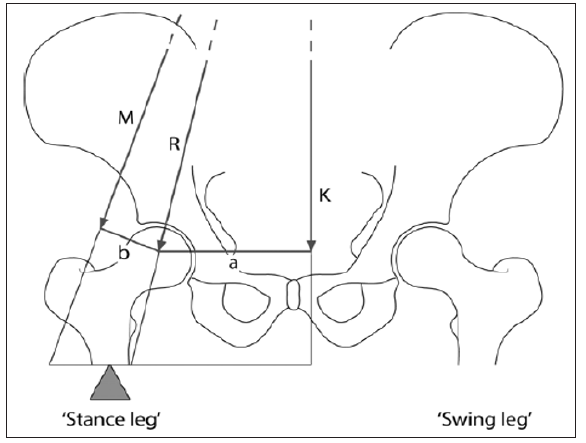 Click here to view Large Figure 12 biomedres-openaccess-journal-bjstr